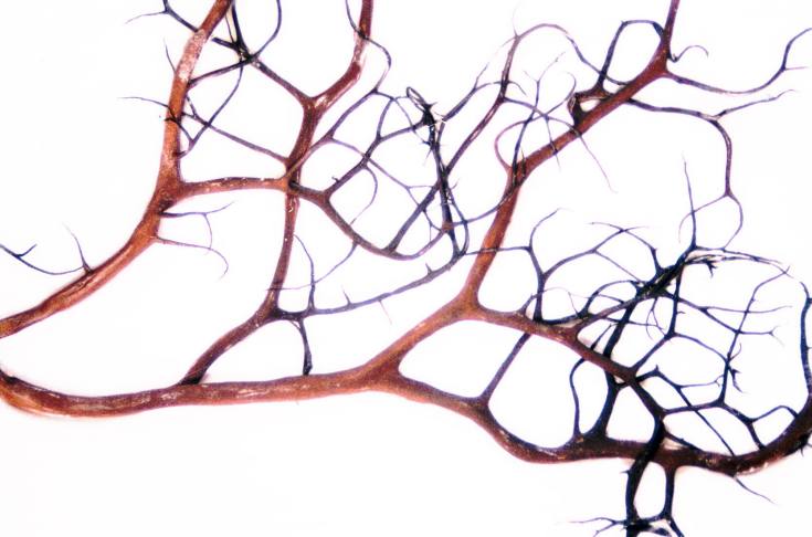 Witch's Hair Lichen