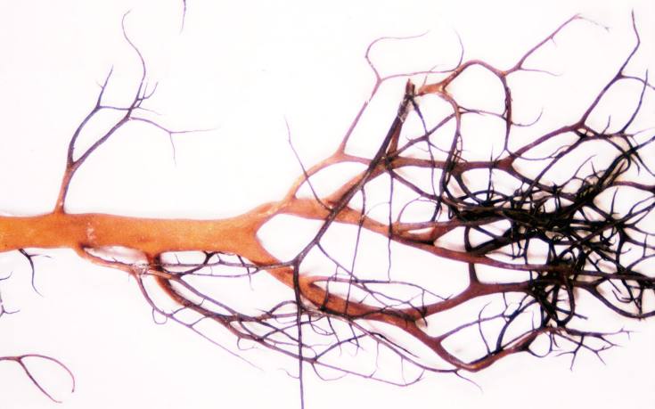 Witch's Hair Lichen